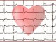 Campo Giuriati, giovedì 16, cuore protagonista immage cardio cuore RM